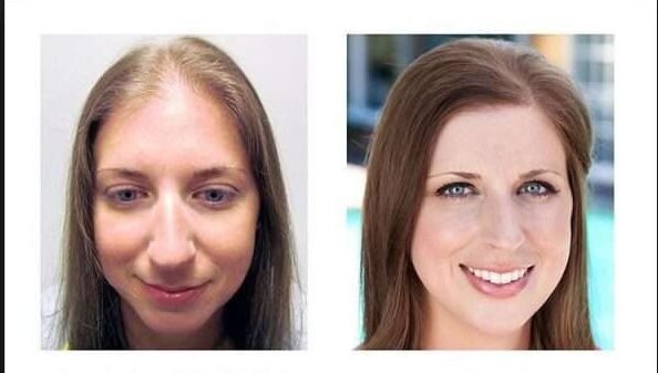 BEFORE-AND-AFTER-HAIR-CINDY-1-768×383