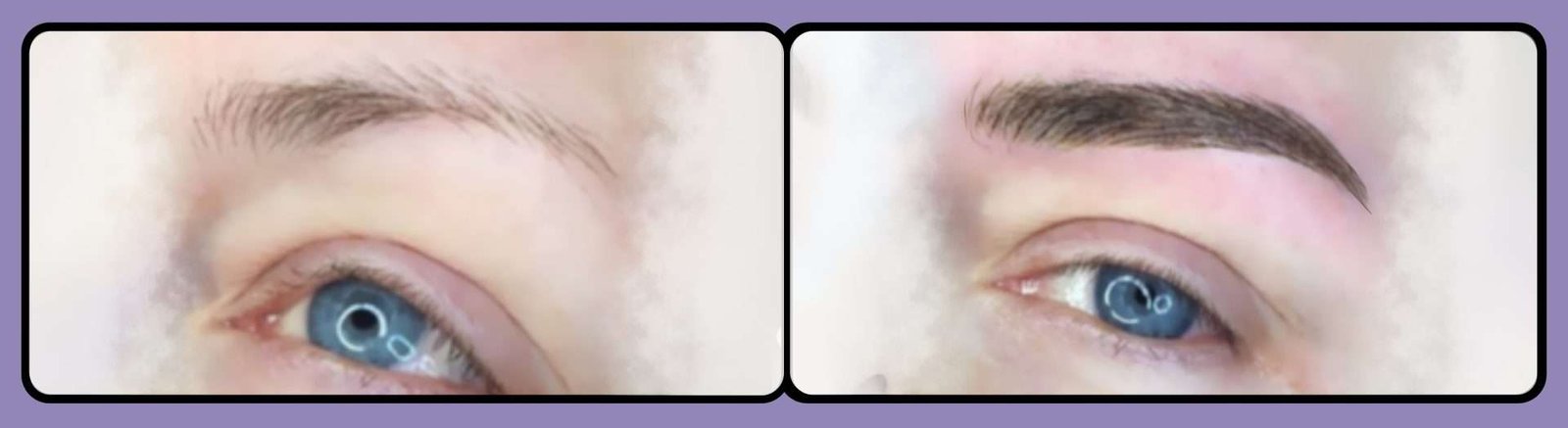 Neveskin™-Revolutionary-Skin-and-Body-Sculpting-Technology