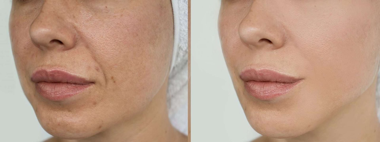 b-and-a-tammy-face-scaled