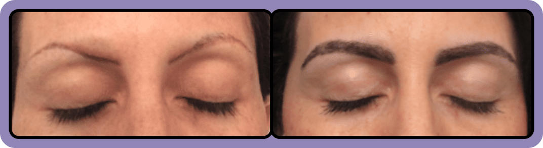 Regenerative Medicine in Littleton & Las Vegas