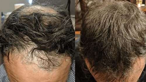 Regenerative Medicine in Littleton & Las Vegas