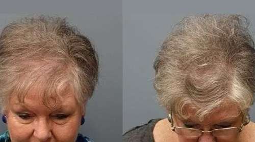 Regenerative Medicine in Littleton & Las Vegas