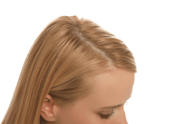 hair-restoration-for-women