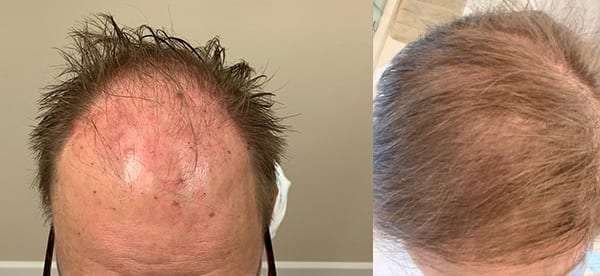 terry-before-after-1