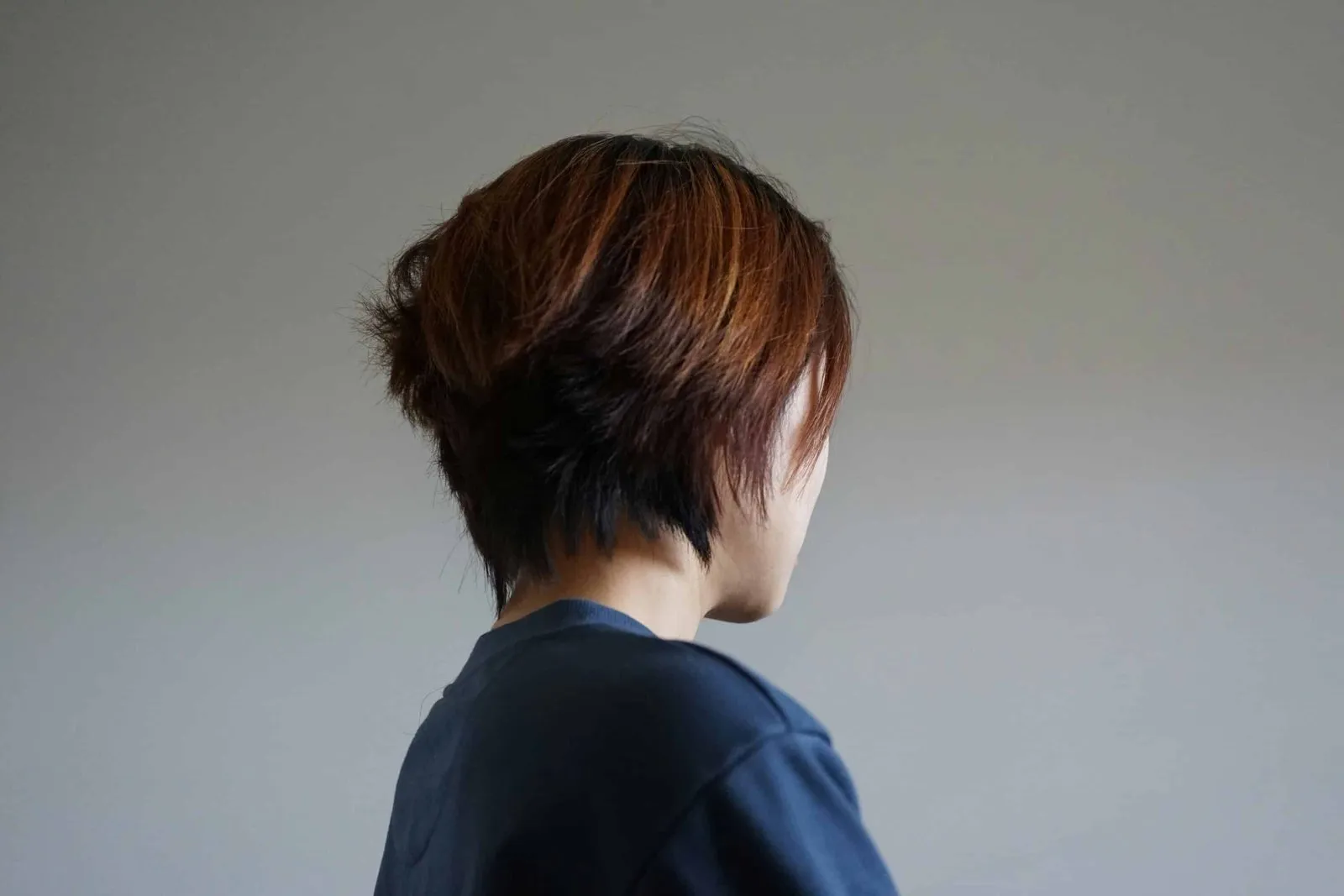 How Much Does Hair Restoration Cost For Men?