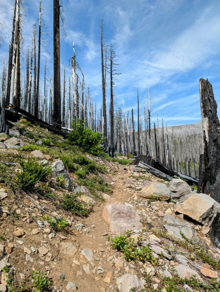 Will Baldness Be Cured By 2030 Male?