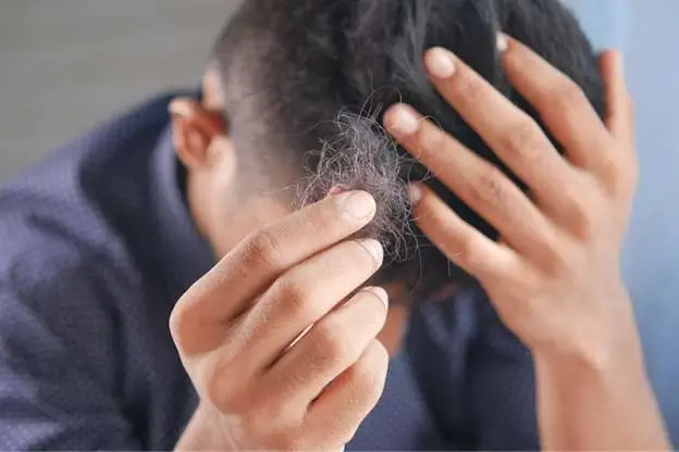 Patient considering FUE hair transplant at Beyond Stem Cells