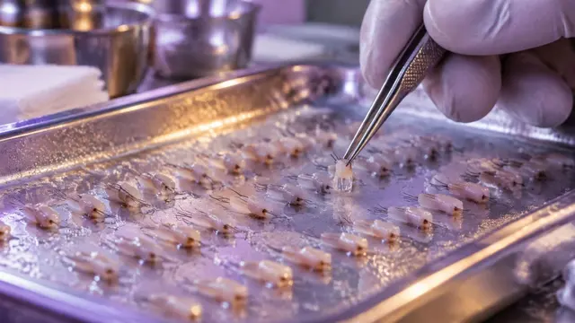 Tiny hair follicle grafts arranged on a sterile tray with gloved fingertips holding fine forceps